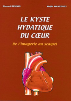 Le kyste hydatique du coeur - أحمد بنيس