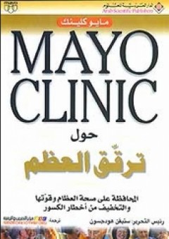 Mayo Clinic حول ترقق العظم - ستيفن هودجسون