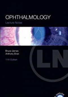 Lecture Notes: Ophthalmology - Bruce James